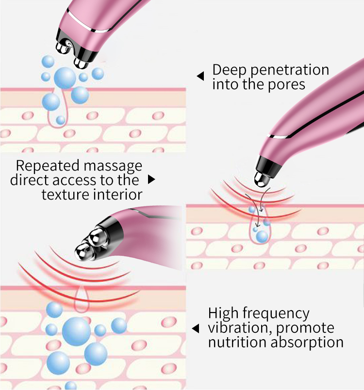 Warm eye beauty instrument, how to do dark circles, how to do bags under the eyes, eye beauty instrument