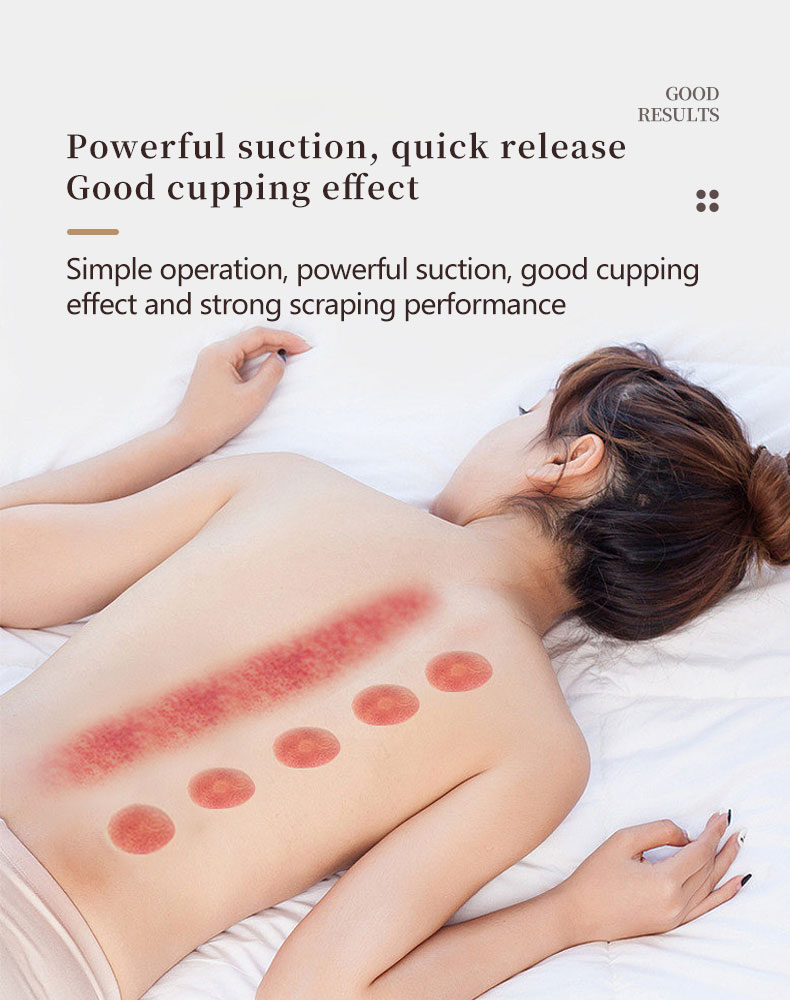 Cupping Beauty Device